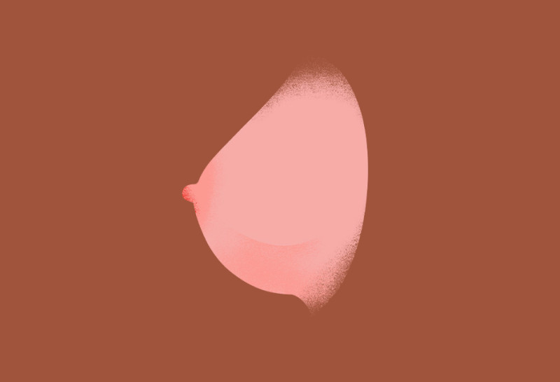 breast-cancer-type-illustration-oc