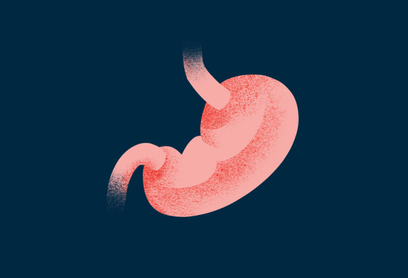 gastric-cancer-type-illustration-oc