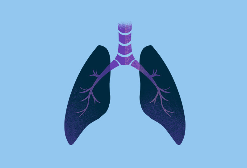 lung-cancer-type-illustration-oc