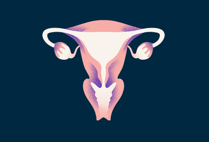 ovarian-cancer-type-illustration-oc