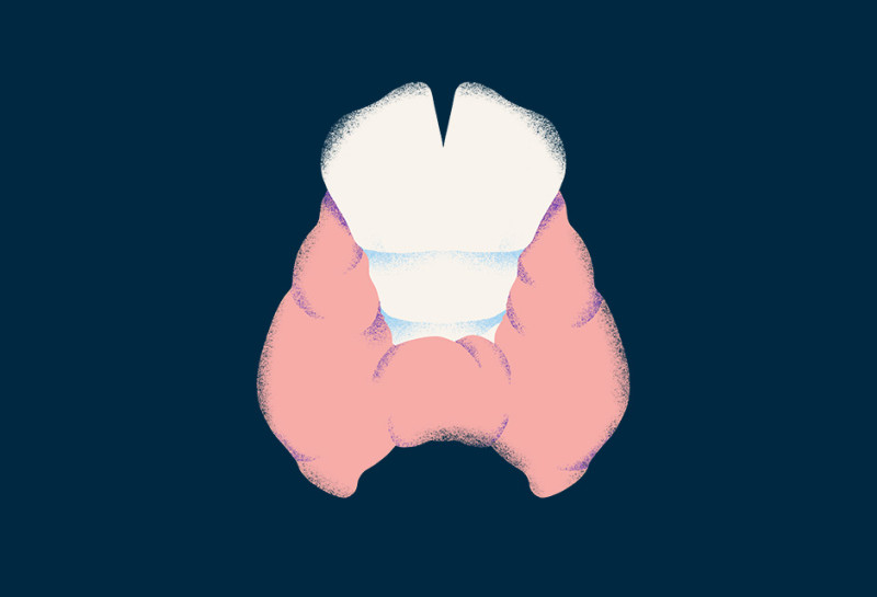thyroid cancer type illustration oc