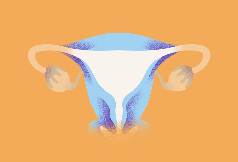 uterine cancer type illustration oc