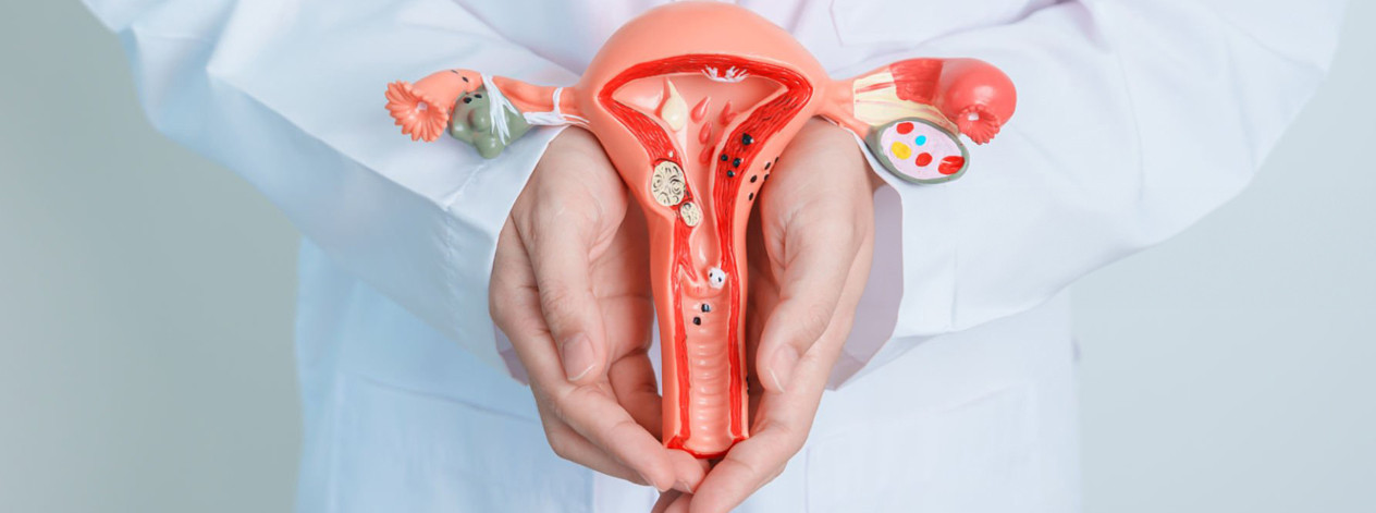 uterine-cancer-doctor-holding-urine-muliage